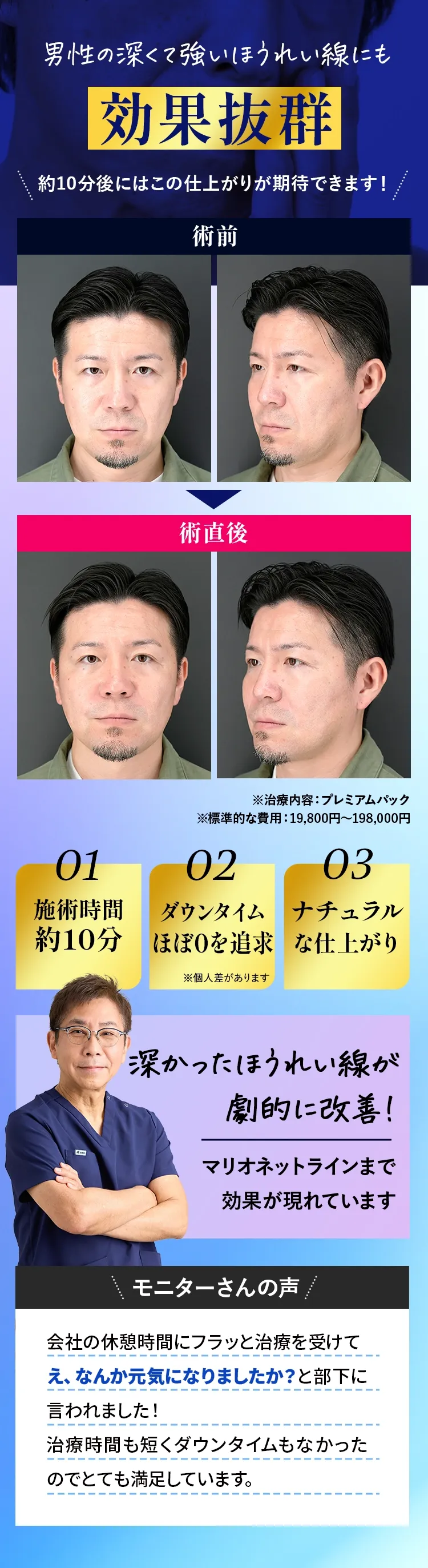男性の深いほうれい線にも効果抜群