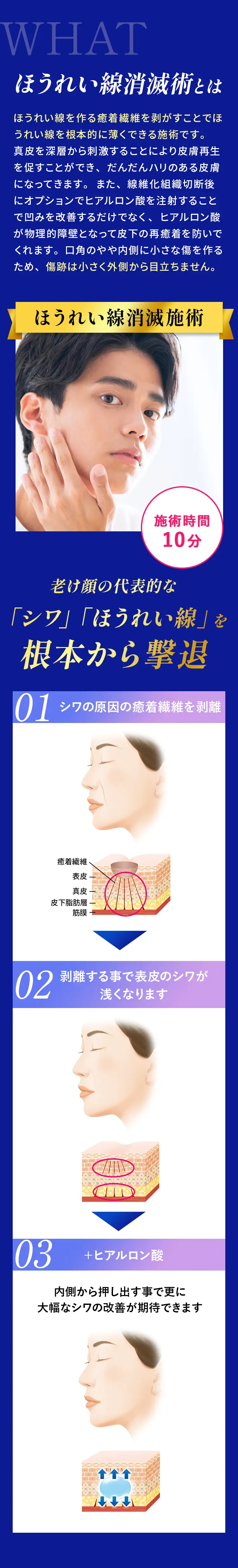 ほうれい線消滅術とは