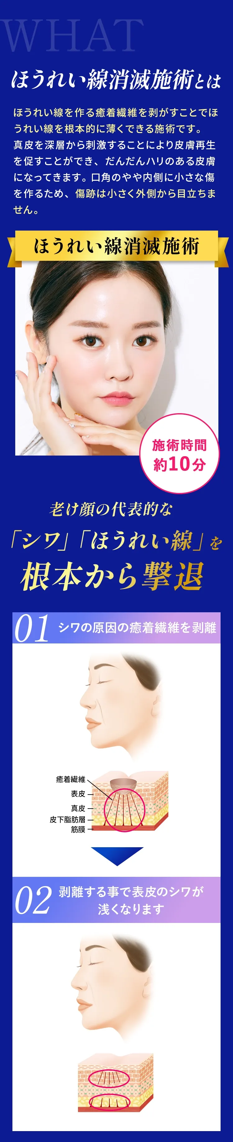 ほうれい線消滅術とは