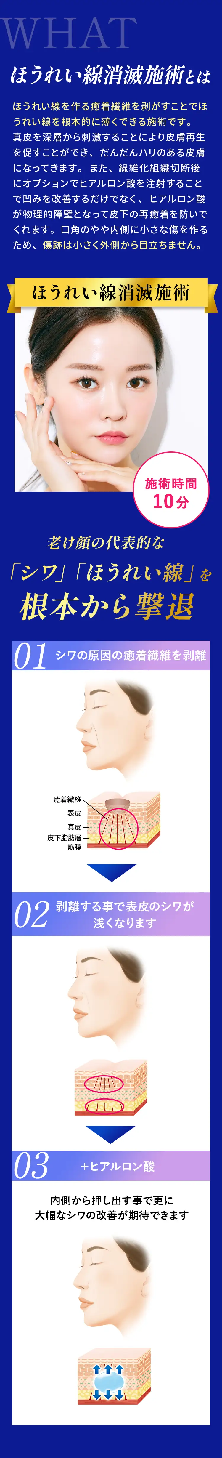 ほうれい線消滅術とは